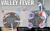Valley-fever-4